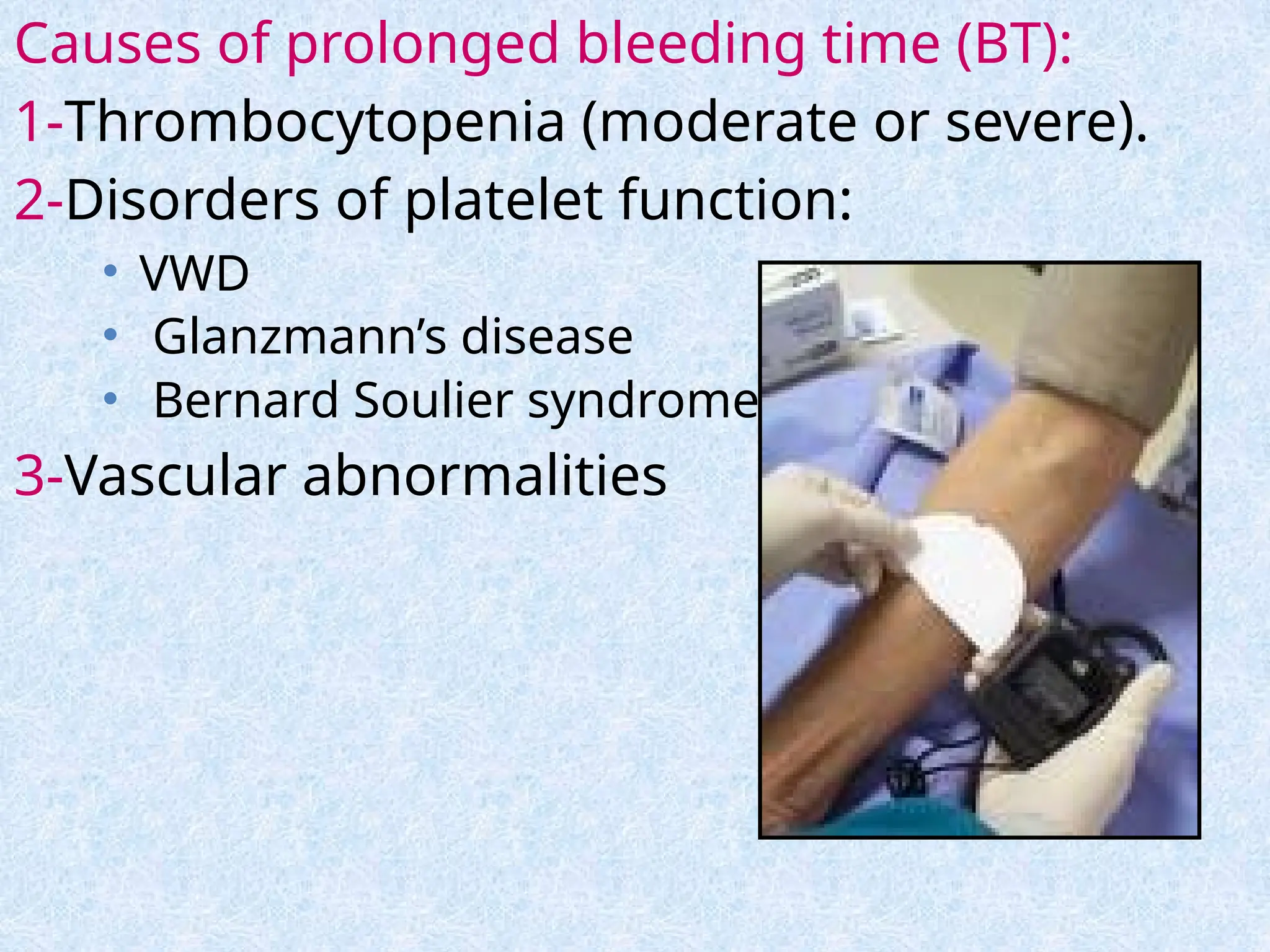Causes of prolonged bleeding time (BT):
1-Thrombocytopenia (moderate or severe).
2-Disorders of platelet function:
• VWD
• Glanzmann’s disease
• Bernard Soulier syndrome
3-Vascular abnormalities
 