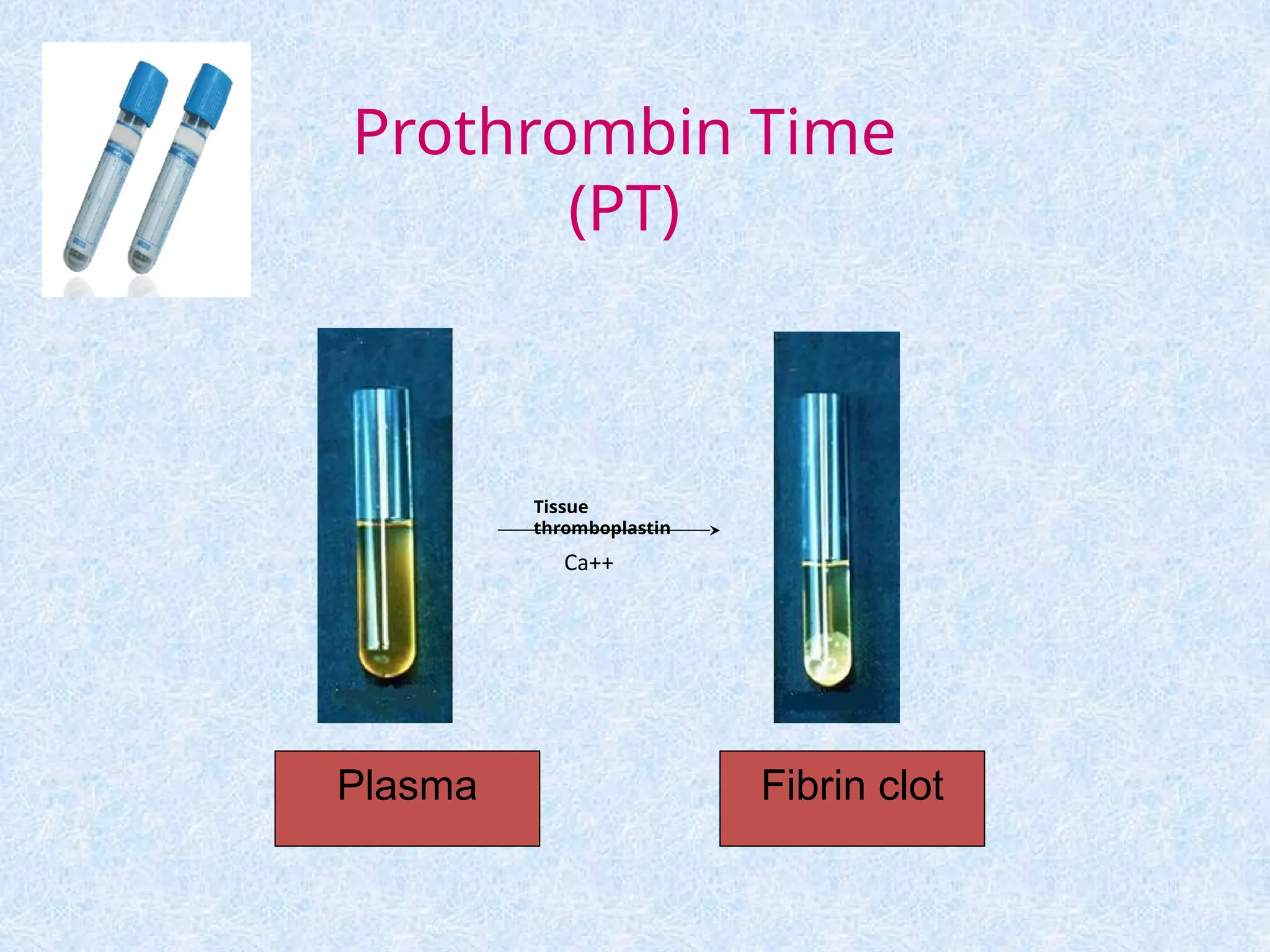 Prothrombin Time
(PT)
Tissue
thromboplastin
Ca++
Fibrin clot
Plasma
 