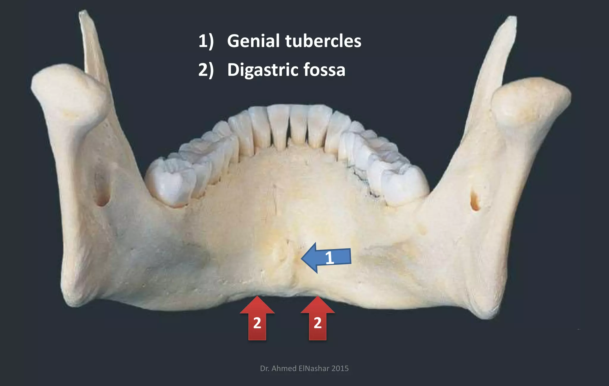 skeleton on head + bony features of mandible 2018