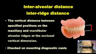 01- Occlusion in prosthodontics introduction -5th year | PPTX
