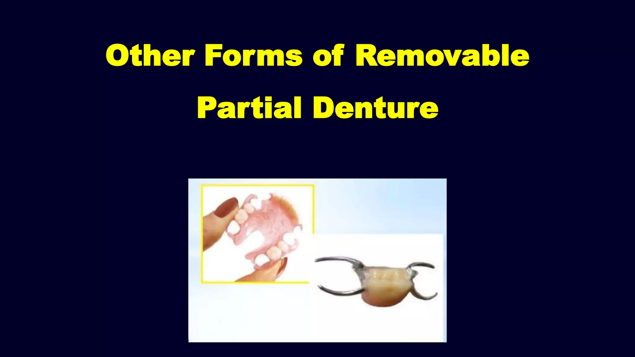 Other Forms of Removable
Partial Denture
 