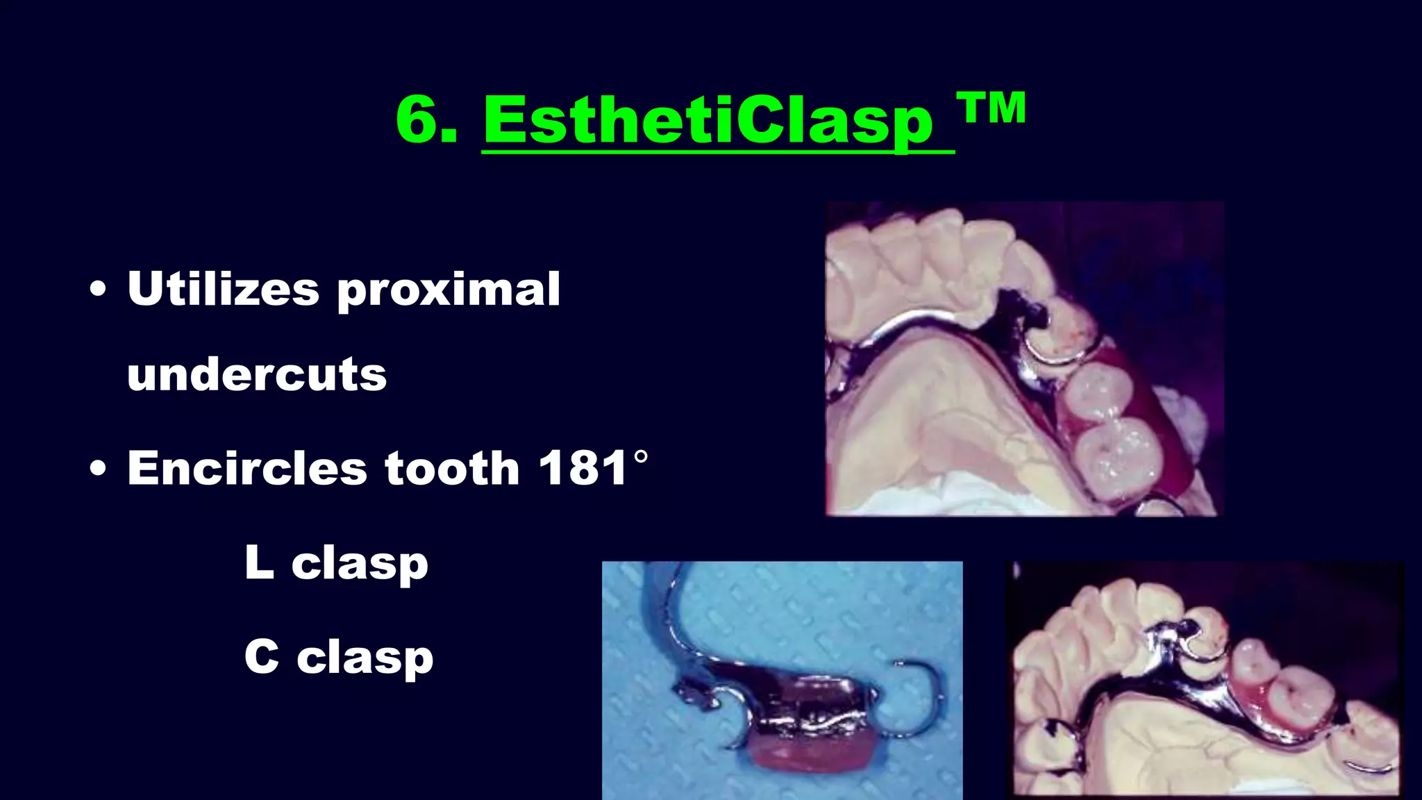 • Utilizes proximal
undercuts
• Encircles tooth 181°
L clasp
C clasp
6. EsthetiClasp TM
 