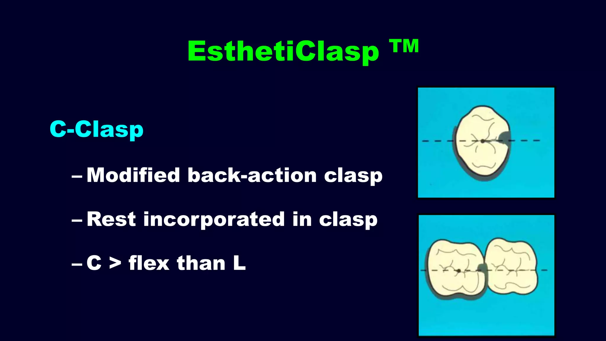C-Clasp
– Modified back-action clasp
– Rest incorporated in clasp
– C > flex than L
EsthetiClasp TM
 