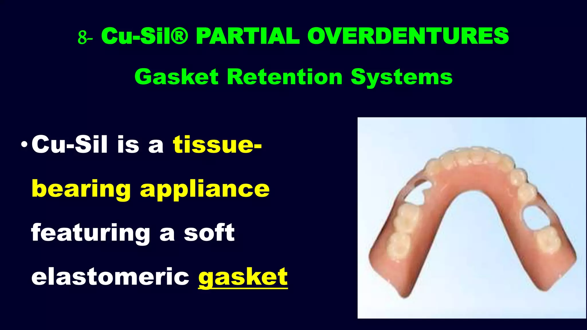 •Cu-Sil is a tissue-
bearing appliance
featuring a soft
elastomeric gasket
8- Cu-Sil® PARTIAL OVERDENTURES
Gasket Retention Systems
 