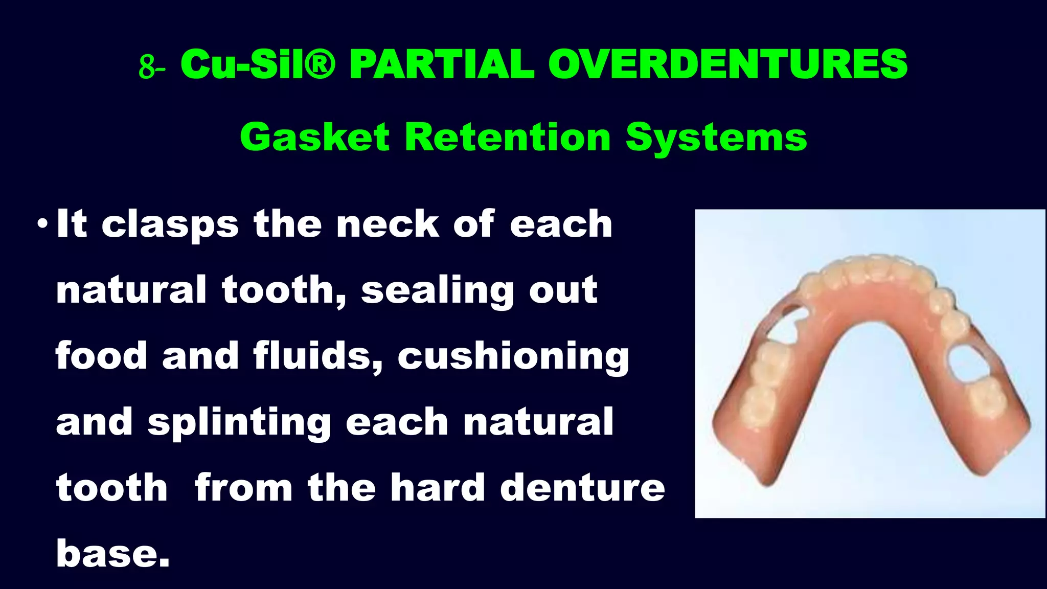 •It clasps the neck of each
natural tooth, sealing out
food and fluids, cushioning
and splinting each natural
tooth from the hard denture
base.
8- Cu-Sil® PARTIAL OVERDENTURES
Gasket Retention Systems
 
