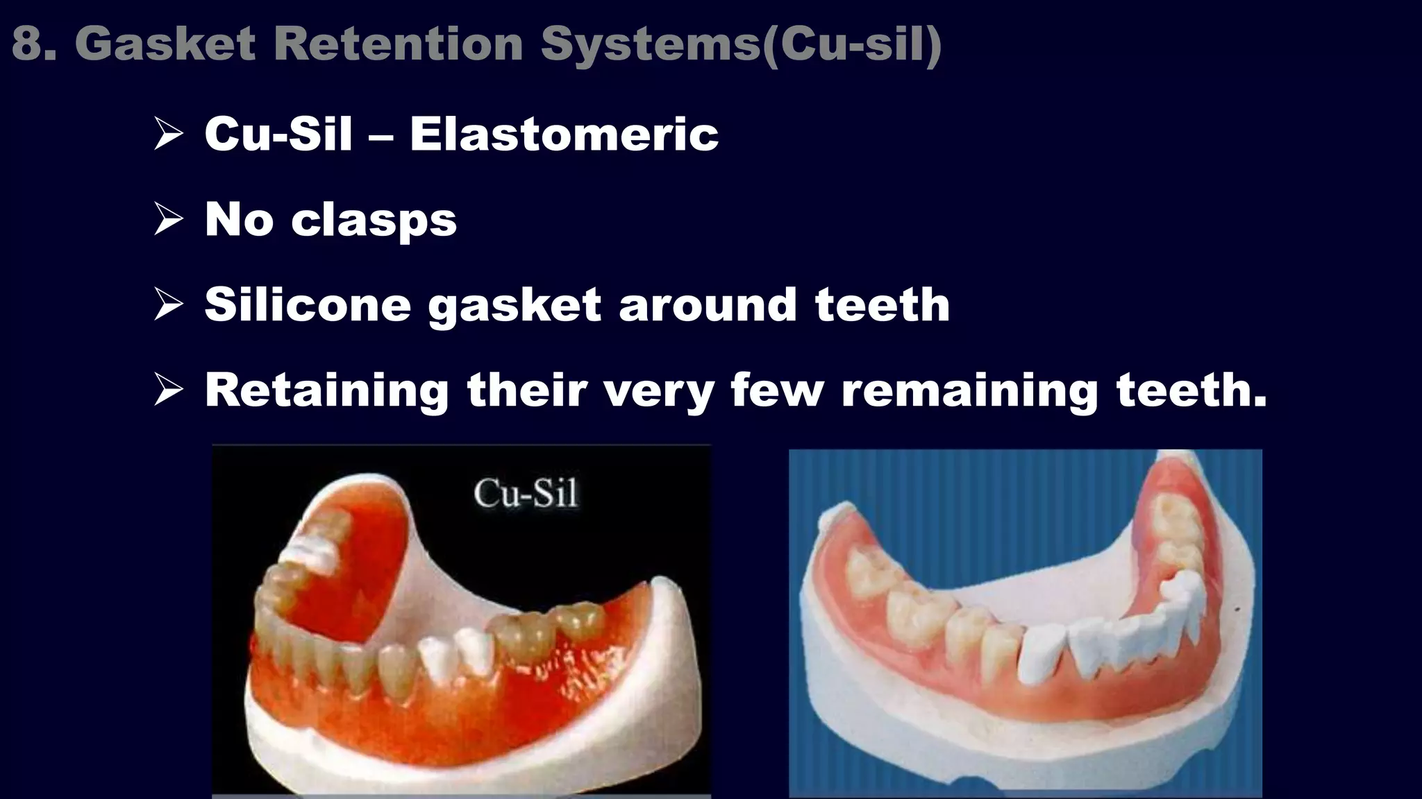  Cu-Sil – Elastomeric
 No clasps
 Silicone gasket around teeth
 Retaining their very few remaining teeth.
8. Gasket Retention Systems(Cu-sil)
 