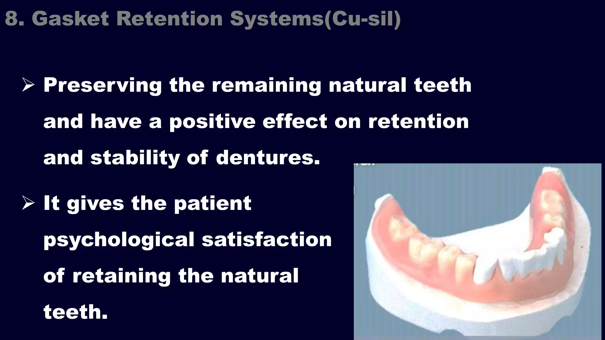  Preserving the remaining natural teeth
and have a positive effect on retention
and stability of dentures.
8. Gasket Retention Systems(Cu-sil)
 It gives the patient
psychological satisfaction
of retaining the natural
teeth.
 