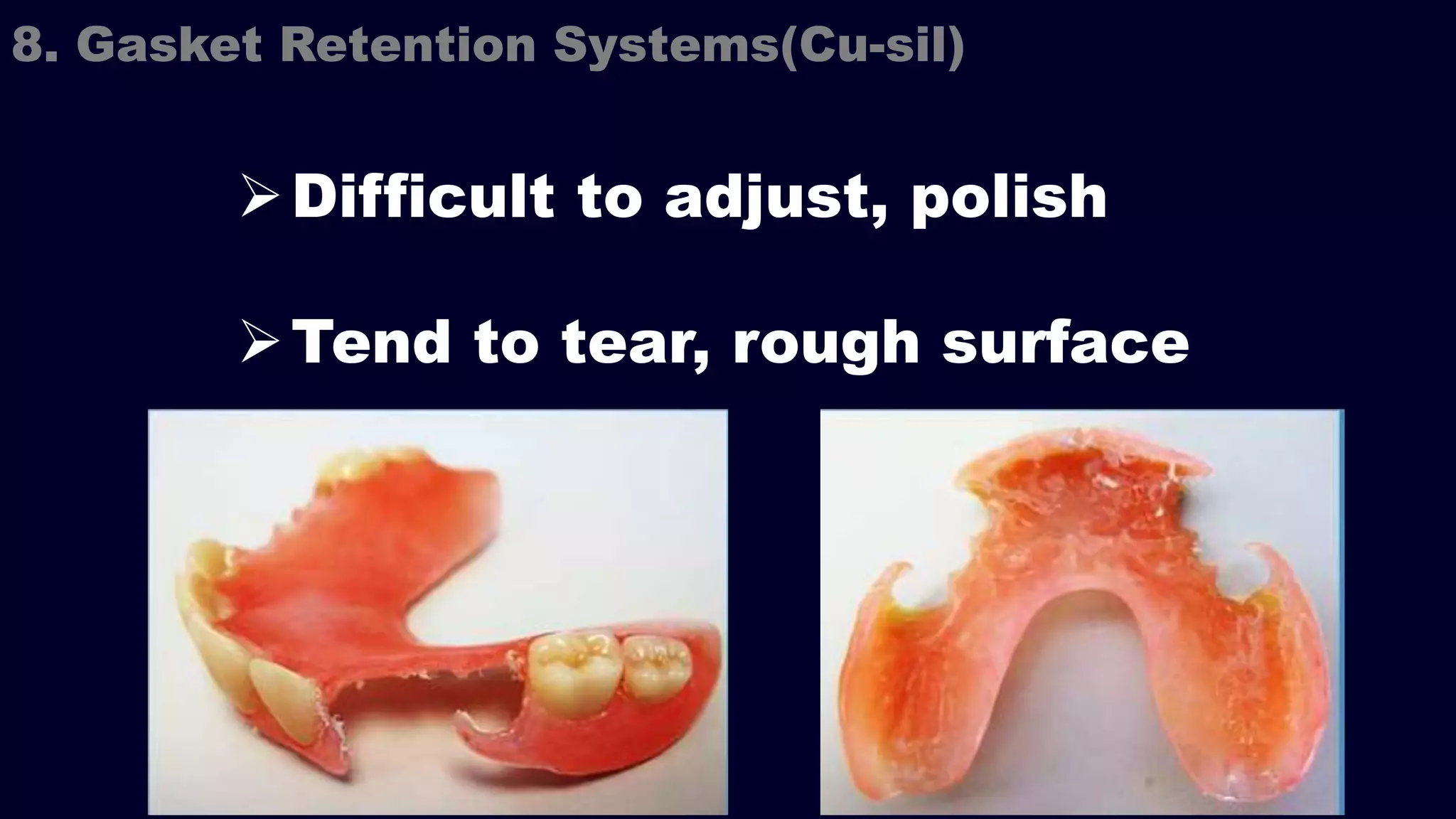 Difficult to adjust, polish
Tend to tear, rough surface
8. Gasket Retention Systems(Cu-sil)
 
