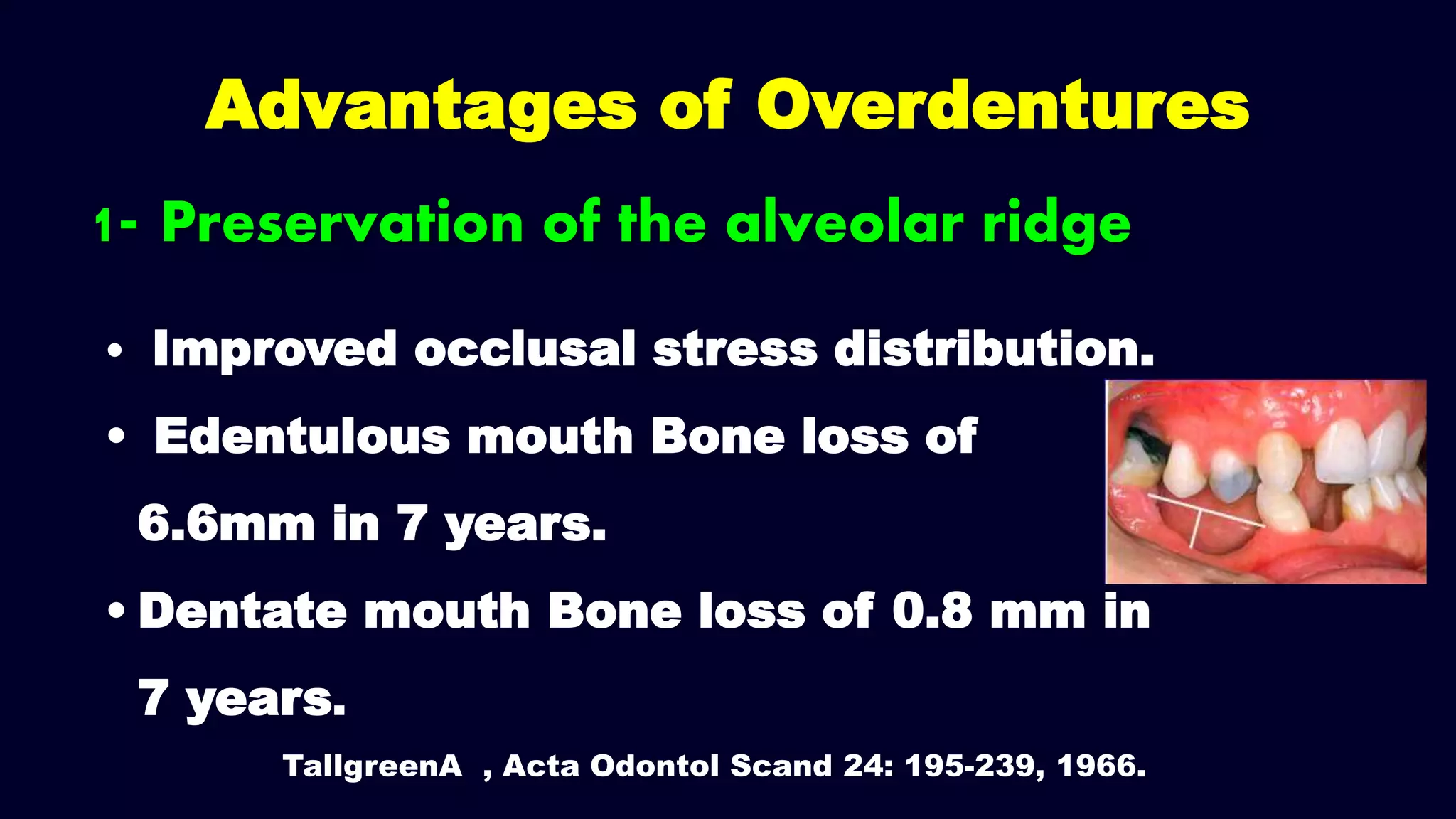 1- Preservation of the alveolar ridge
Advantages of Overdentures
• Improved occlusal stress distribution.
• Edentulous mouth Bone loss of
6.6mm in 7 years.
• Dentate mouth Bone loss of 0.8 mm in
7 years.
TallgreenA , Acta Odontol Scand 24: 195-239, 1966.
 