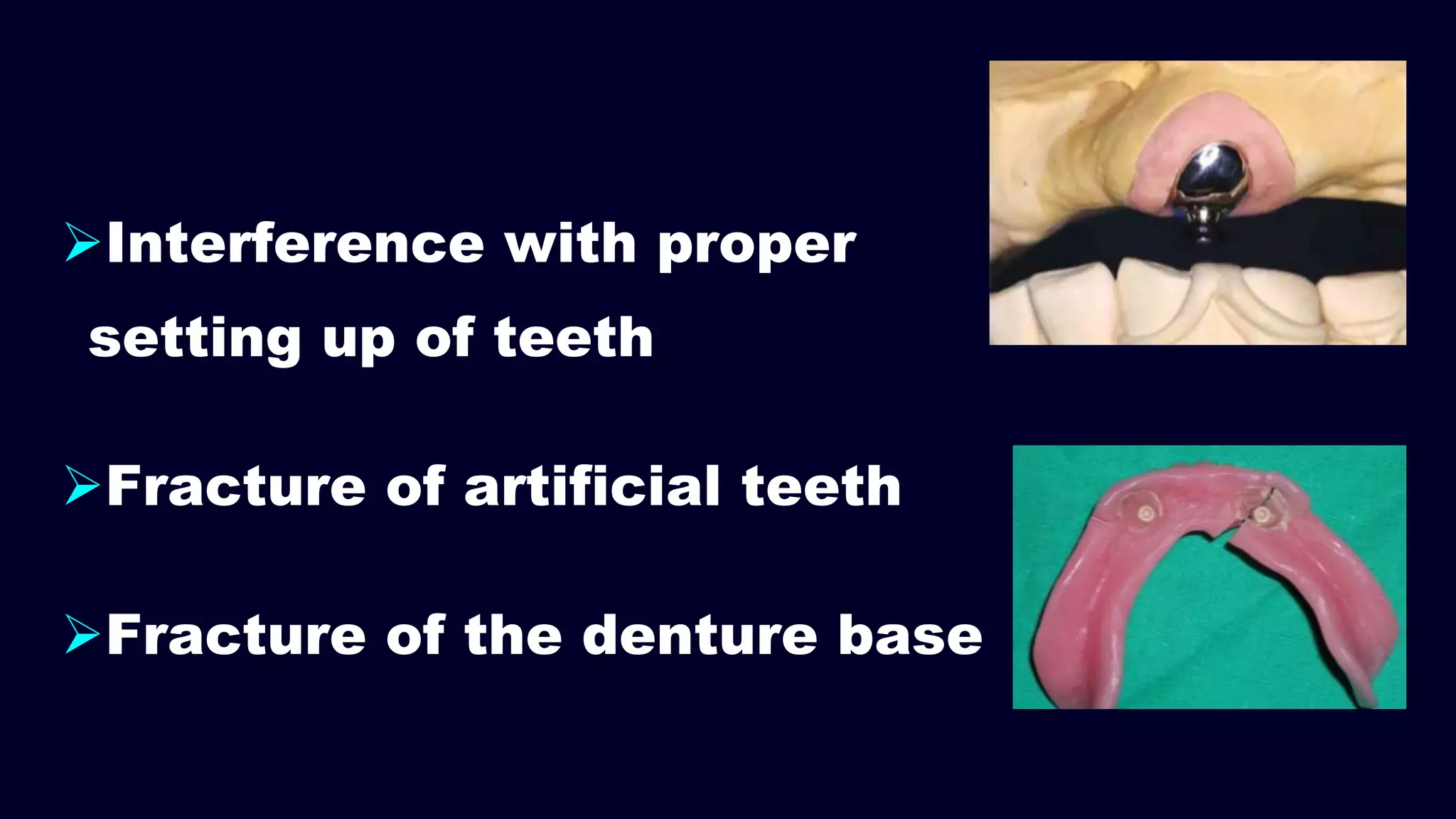 Interference with proper
setting up of teeth
Fracture of artificial teeth
Fracture of the denture base
 