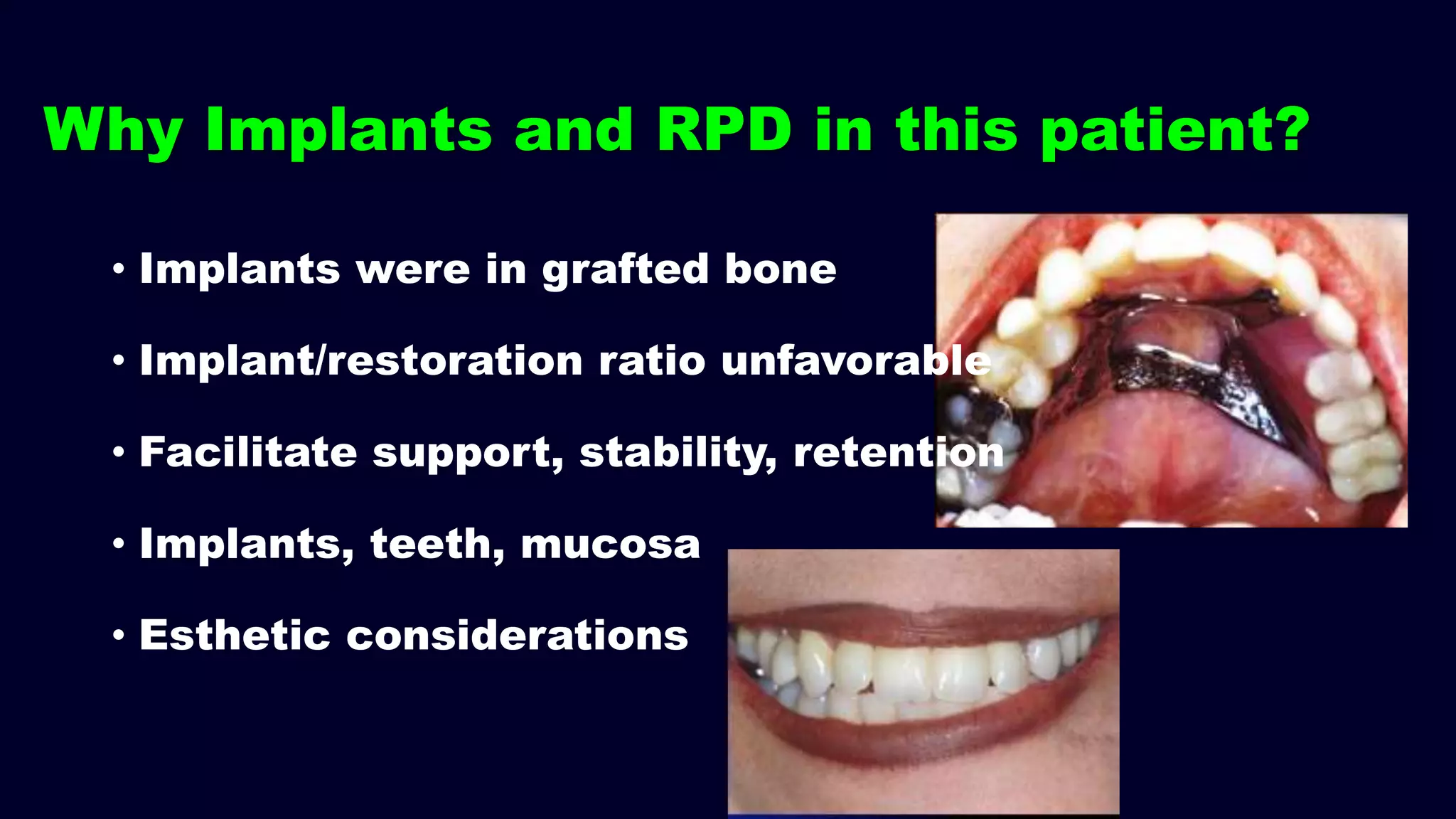 Why Implants and RPD in this patient?
• Implants were in grafted bone
• Implant/restoration ratio unfavorable
• Facilitate support, stability, retention
• Implants, teeth, mucosa
• Esthetic considerations
 