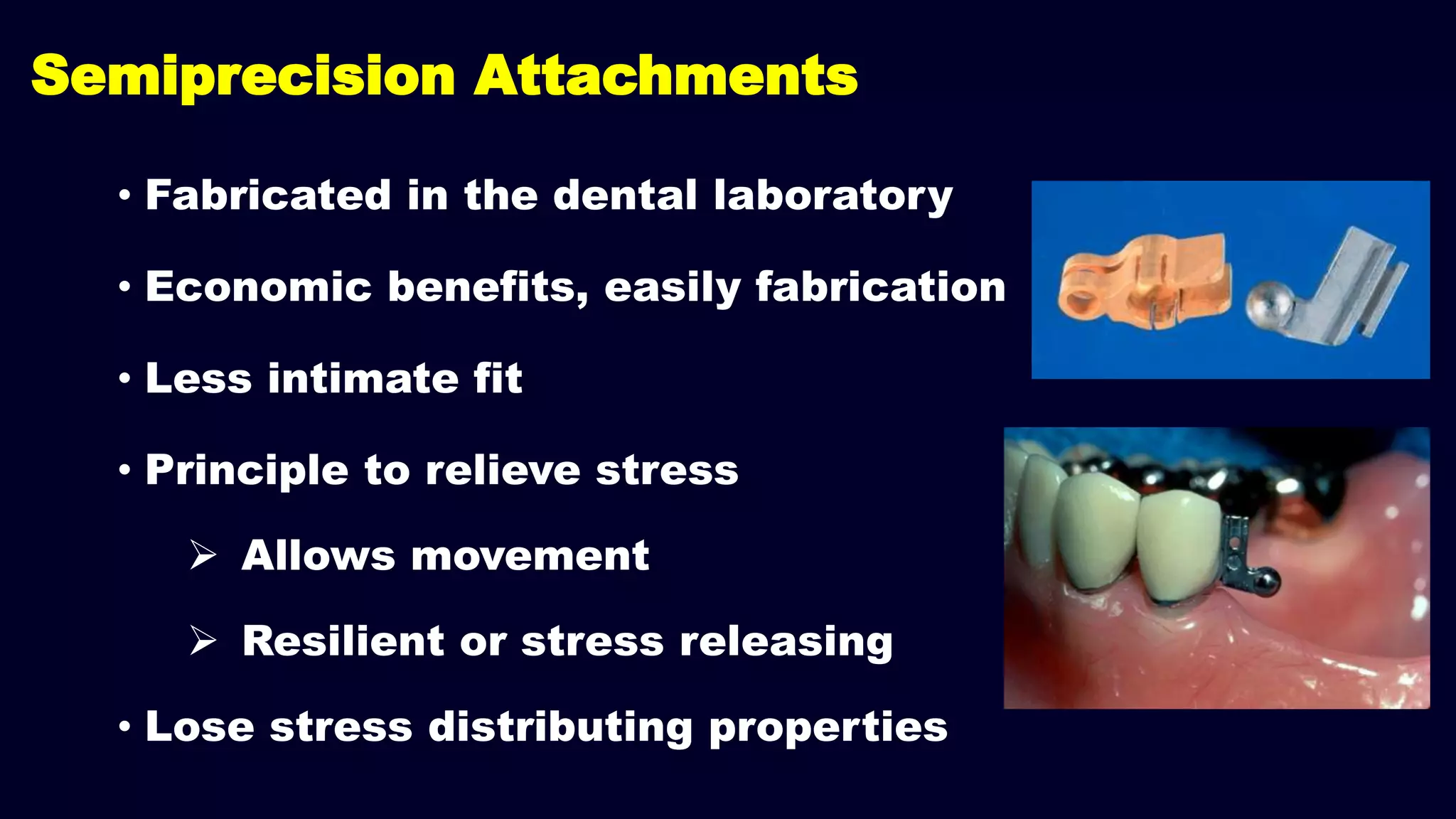 • Fabricated in the dental laboratory
• Economic benefits, easily fabrication
• Less intimate fit
• Principle to relieve stress
 Allows movement
 Resilient or stress releasing
• Lose stress distributing properties
Semiprecision Attachments
 