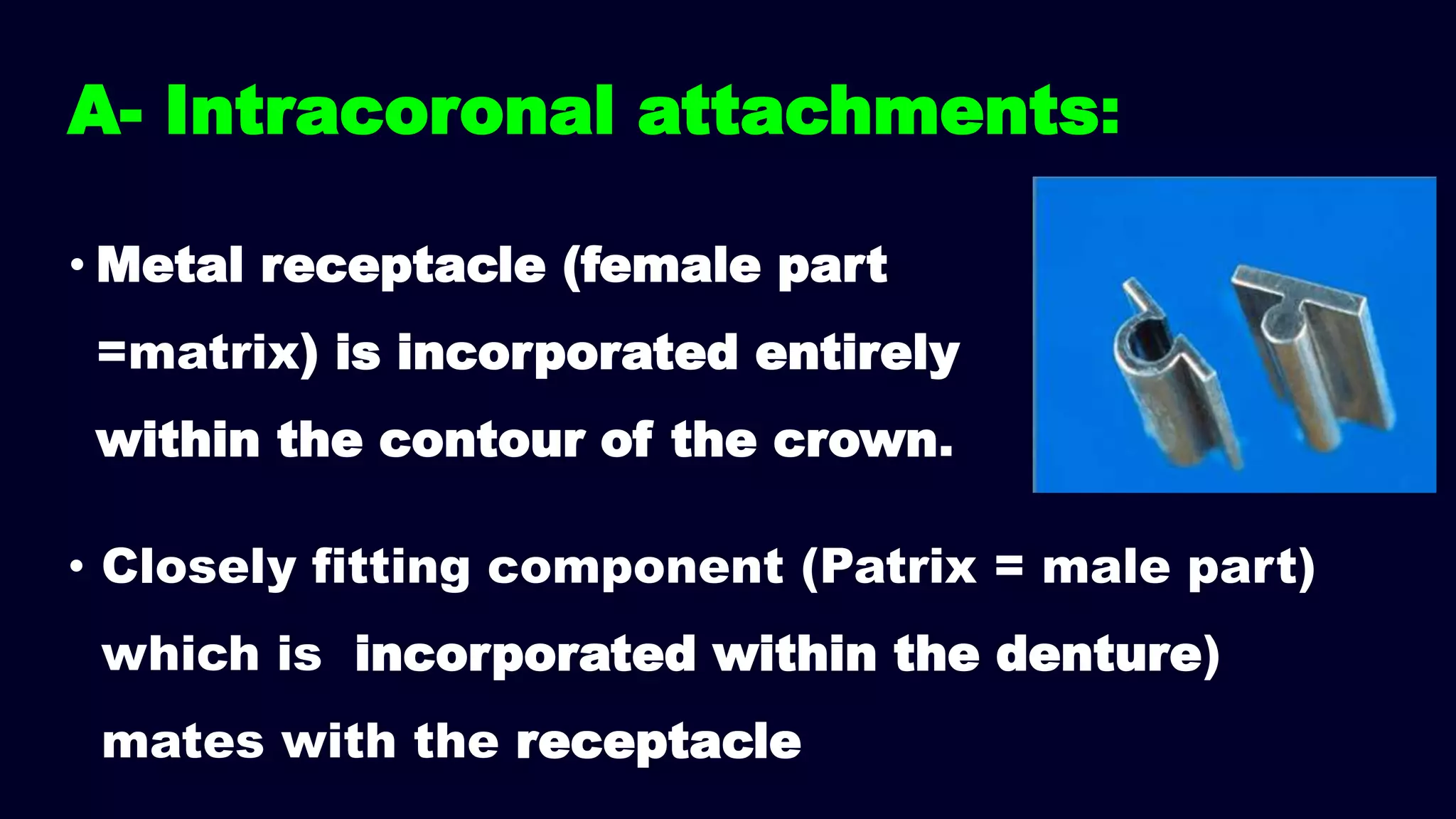 • Metal receptacle (female part
=matrix) is incorporated entirely
within the contour of the crown.
A- Intracoronal attachments:
• Closely fitting component (Patrix = male part)
which is incorporated within the denture)
mates with the receptacle
 