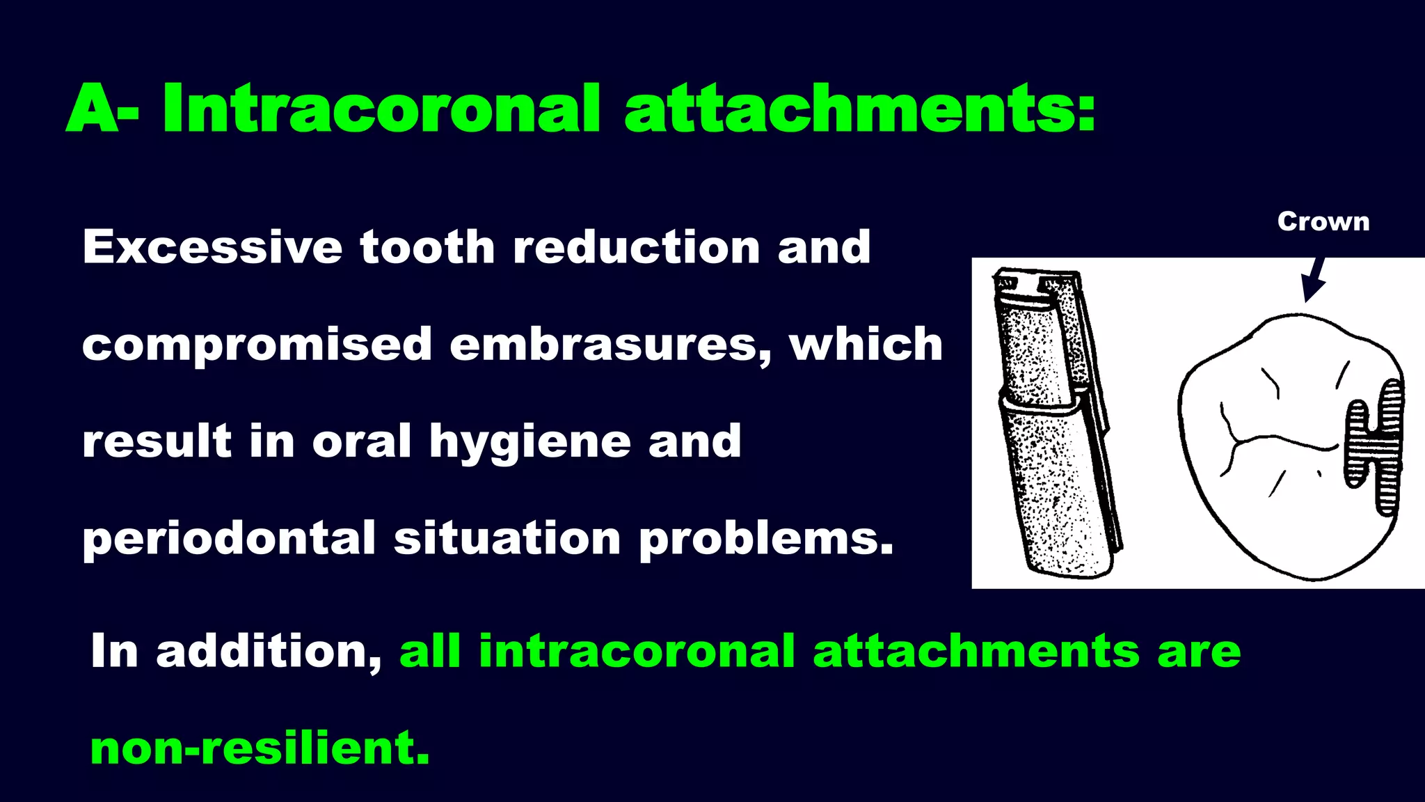 Excessive tooth reduction and
compromised embrasures, which
result in oral hygiene and
periodontal situation problems.
In addition, all intracoronal attachments are
non-resilient.
A- Intracoronal attachments:
Crown
 