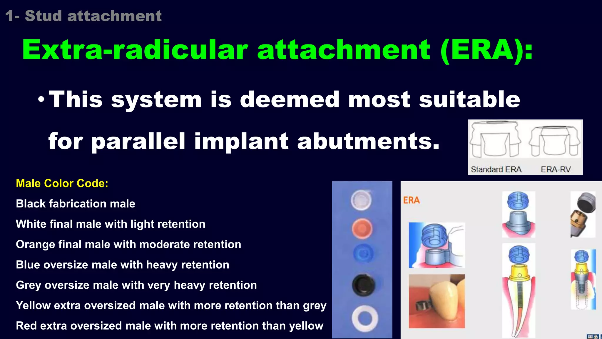 •This system is deemed most suitable
for parallel implant abutments.
Extra-radicular attachment (ERA):
Male Color Code:
Black fabrication male
White final male with light retention
Orange final male with moderate retention
Blue oversize male with heavy retention
Grey oversize male with very heavy retention
Yellow extra oversized male with more retention than grey
Red extra oversized male with more retention than yellow
1- Stud attachment
 