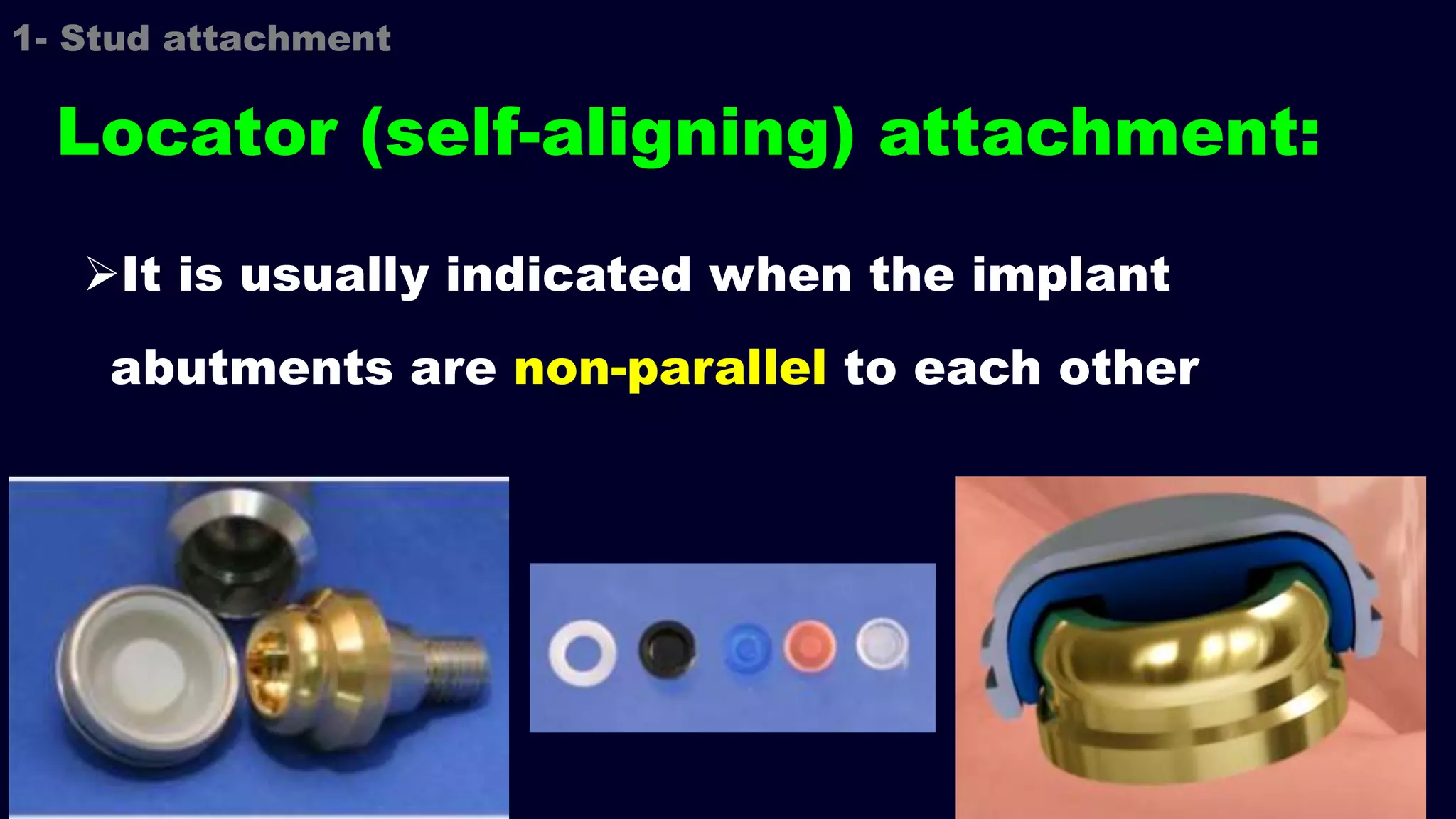 It is usually indicated when the implant
abutments are non-parallel to each other
1- Stud attachment
Locator (self-aligning) attachment:
 