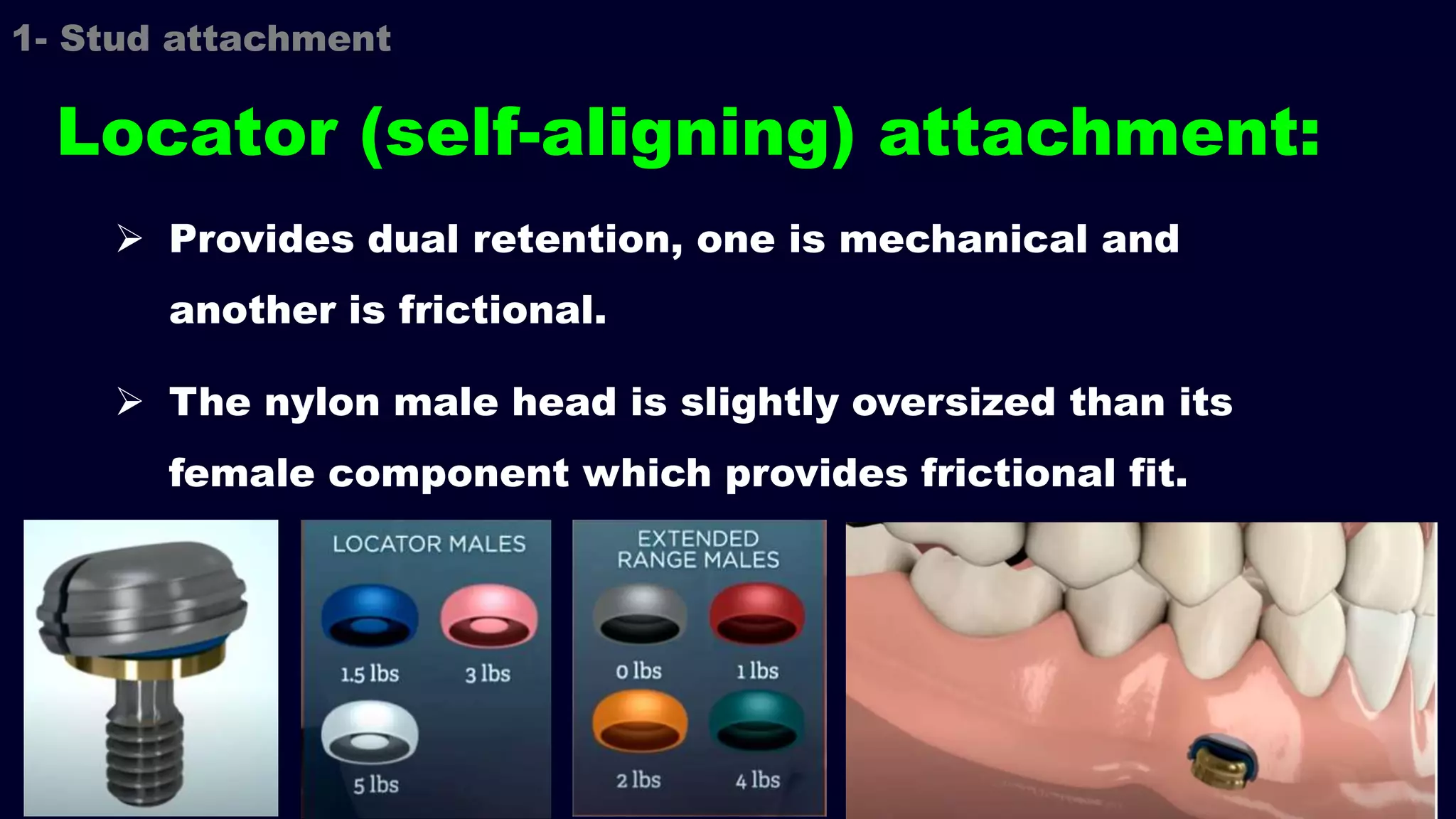  Provides dual retention, one is mechanical and
another is frictional.
 The nylon male head is slightly oversized than its
female component which provides frictional fit.
1- Stud attachment
Locator (self-aligning) attachment:
 