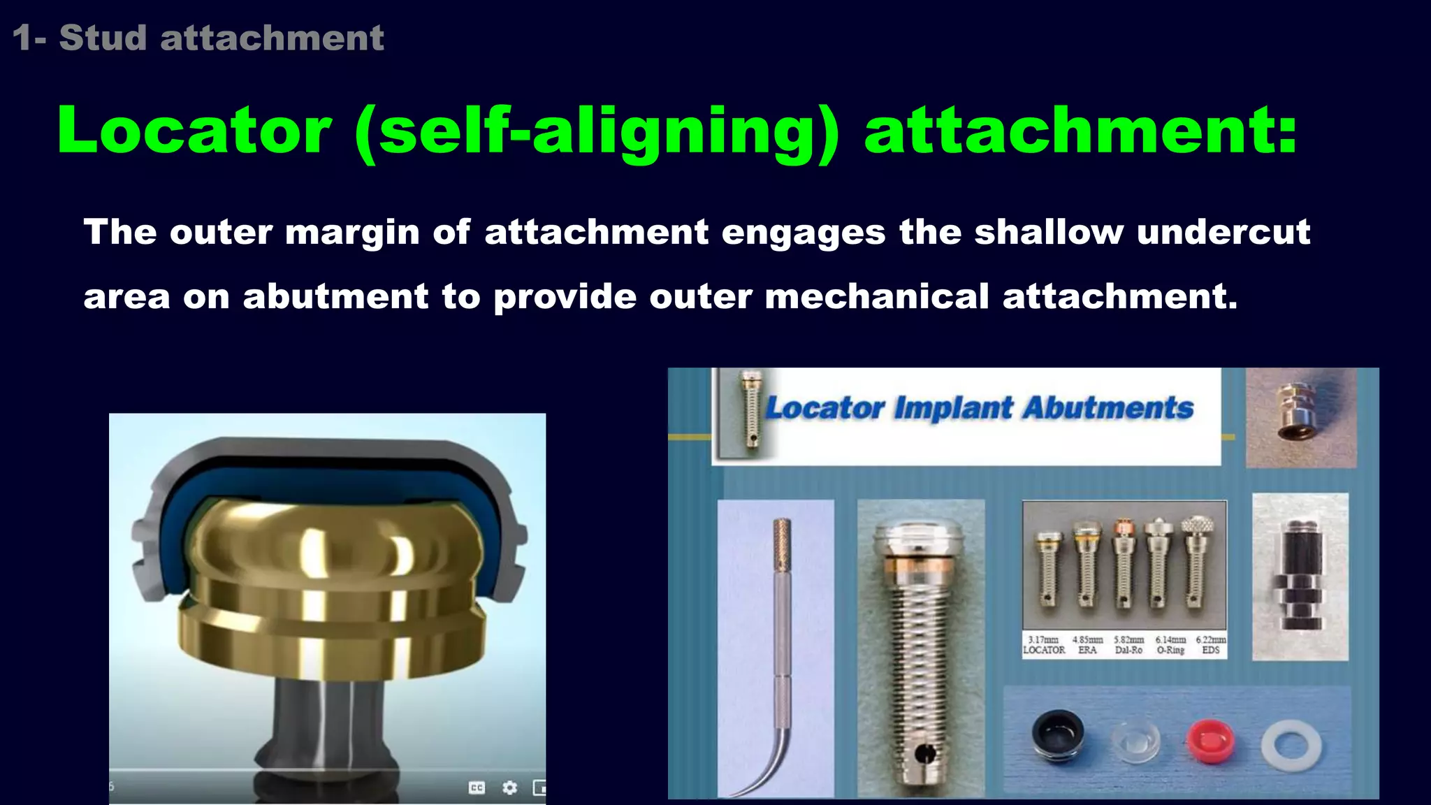 The outer margin of attachment engages the shallow undercut
area on abutment to provide outer mechanical attachment.
Locator (self-aligning) attachment:
1- Stud attachment
 