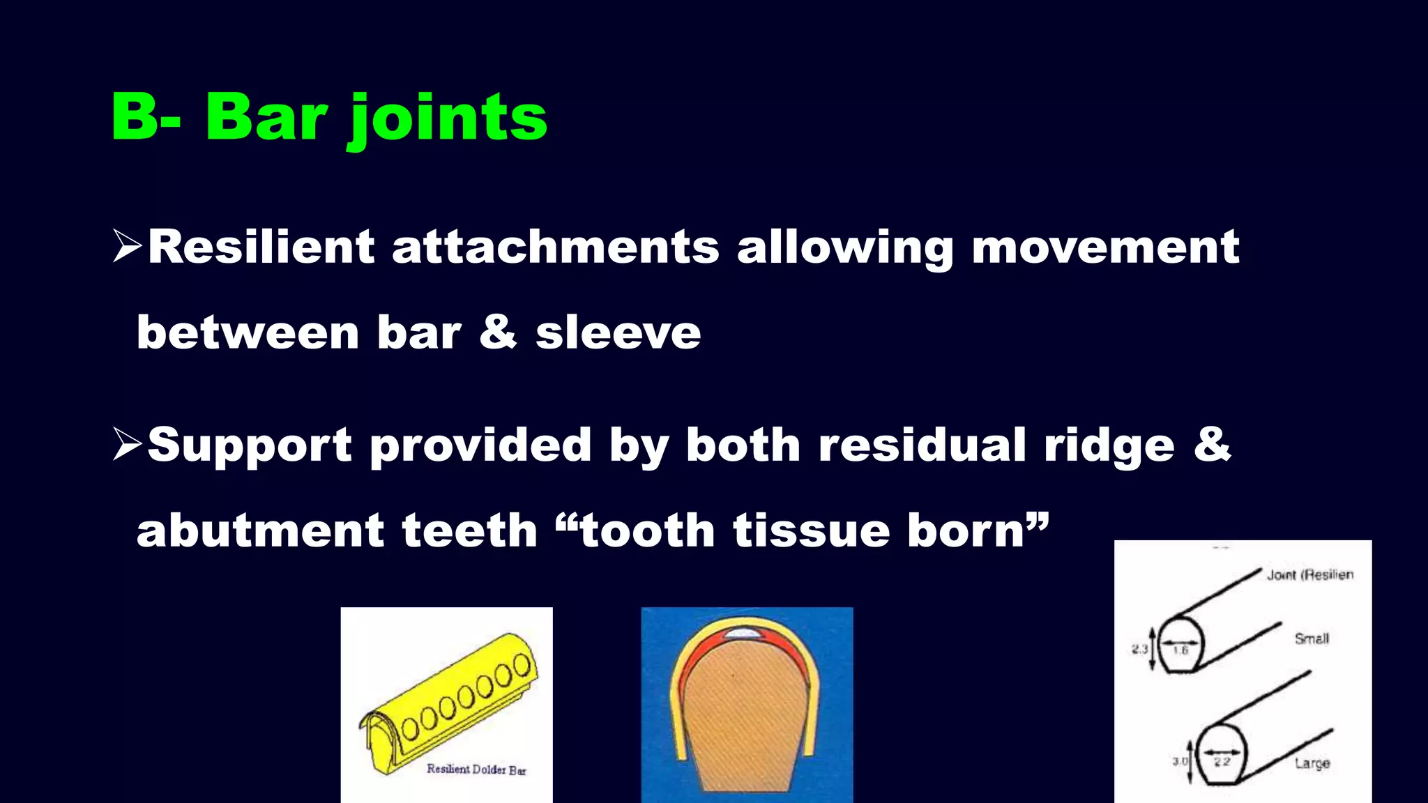 B- Bar joints
Resilient attachments allowing movement
between bar & sleeve
Support provided by both residual ridge &
abutment teeth “tooth tissue born”
 