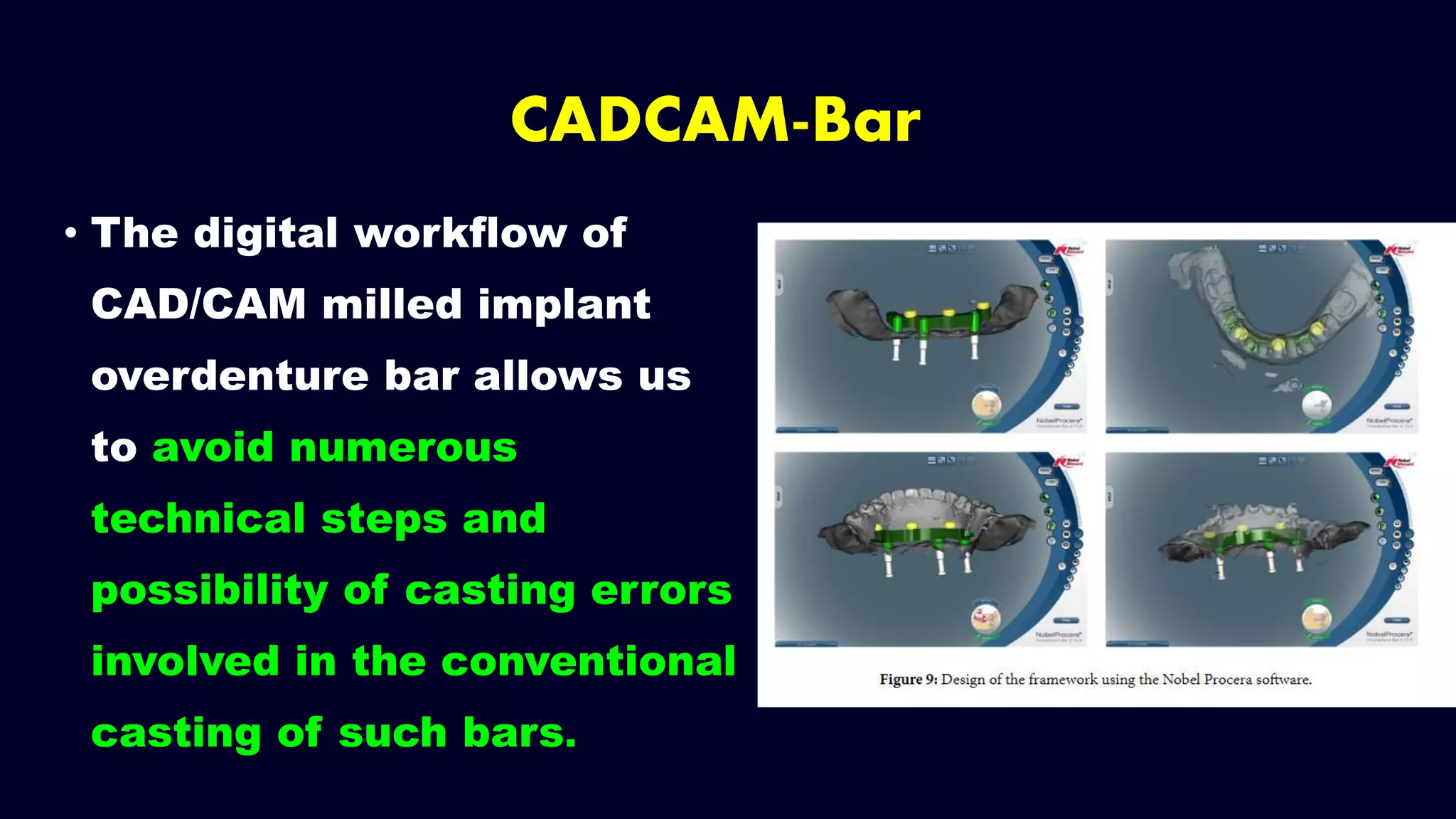 • The digital workflow of
CAD/CAM milled implant
overdenture bar allows us
to avoid numerous
technical steps and
possibility of casting errors
involved in the conventional
casting of such bars.
CADCAM-Bar
 