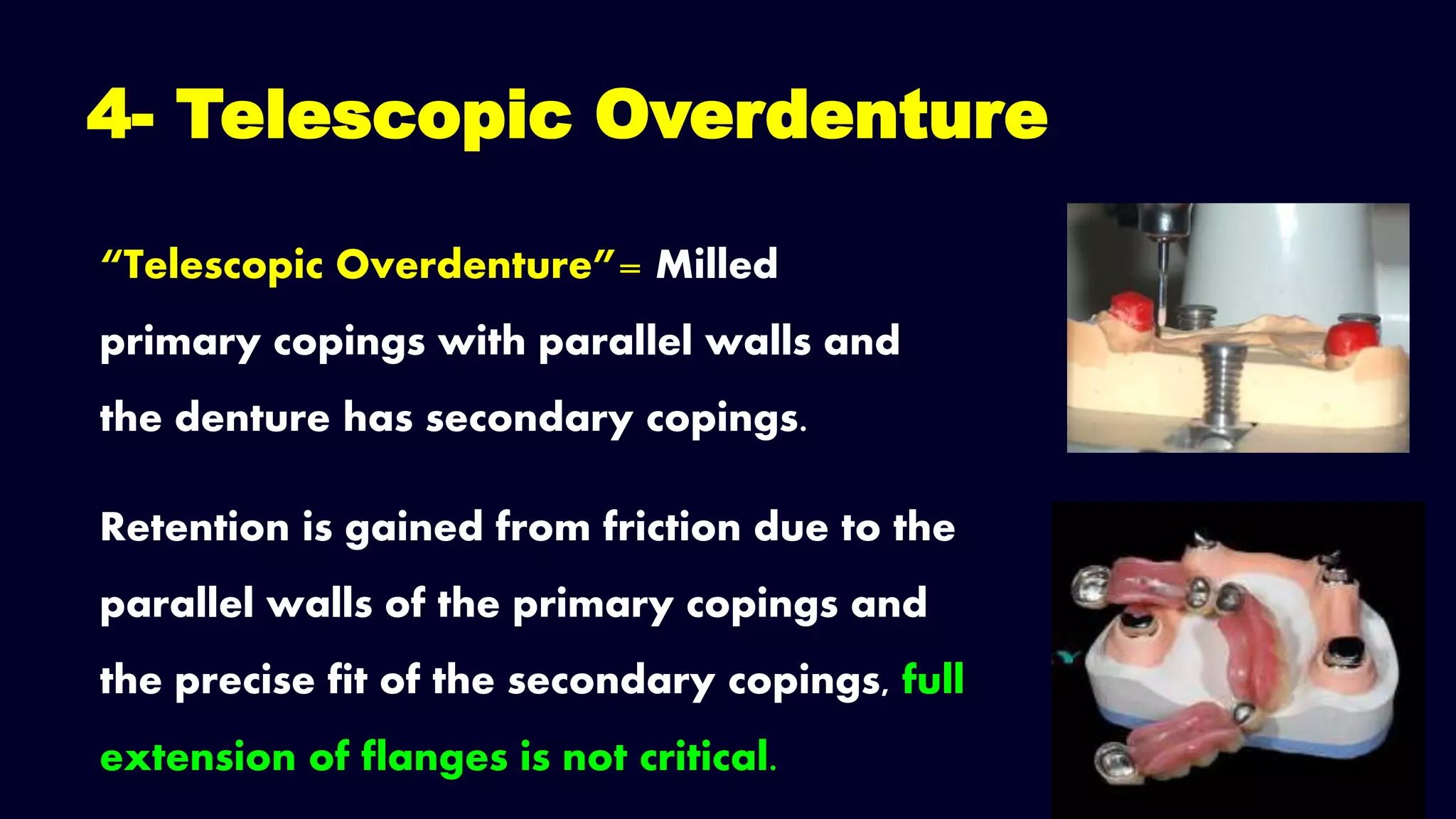 4- Telescopic Overdenture
“Telescopic Overdenture”= Milled
primary copings with parallel walls and
the denture has secondary copings.
Retention is gained from friction due to the
parallel walls of the primary copings and
the precise fit of the secondary copings, full
extension of flanges is not critical.
 