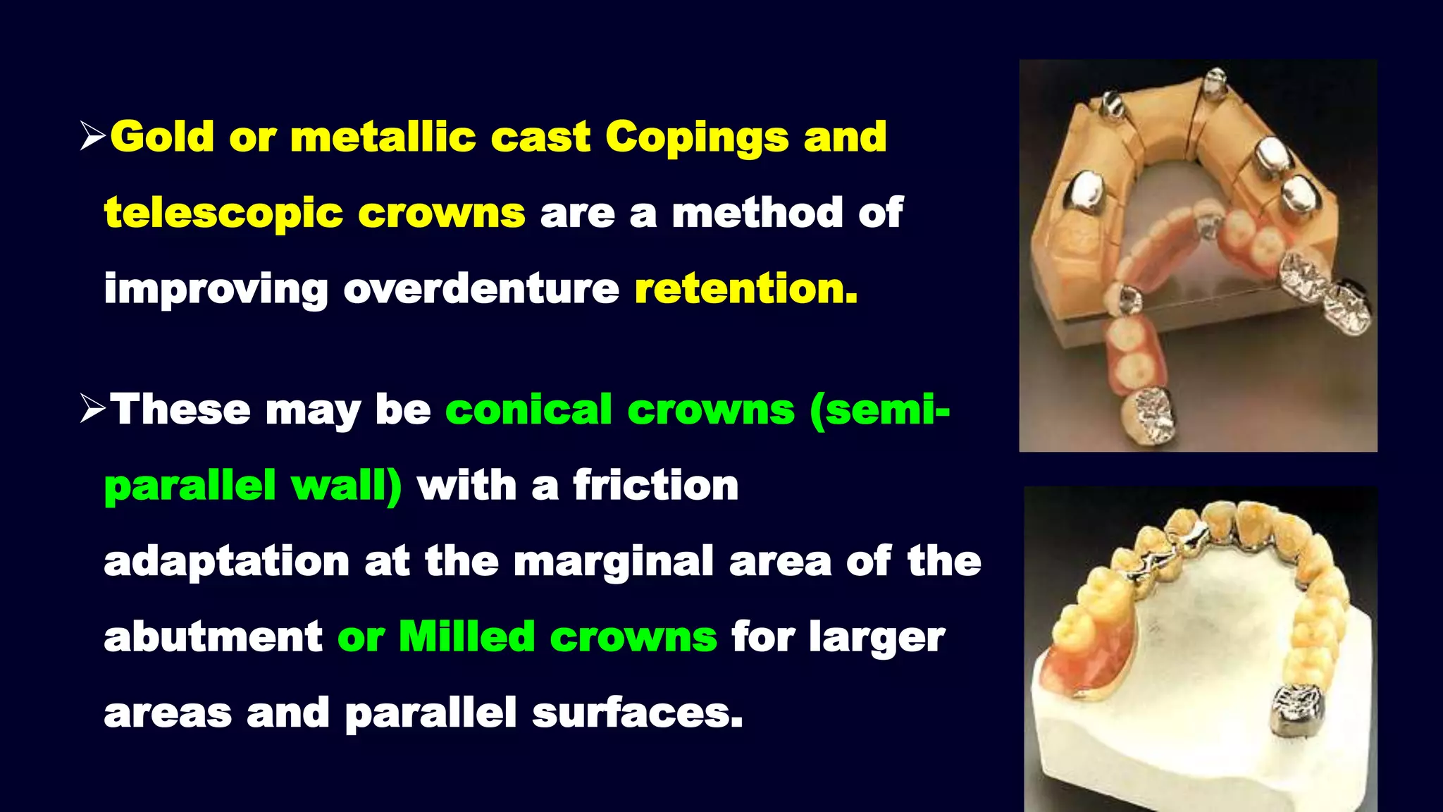 Gold or metallic cast Copings and
telescopic crowns are a method of
improving overdenture retention.
These may be conical crowns (semi-
parallel wall) with a friction
adaptation at the marginal area of the
abutment or Milled crowns for larger
areas and parallel surfaces.
 