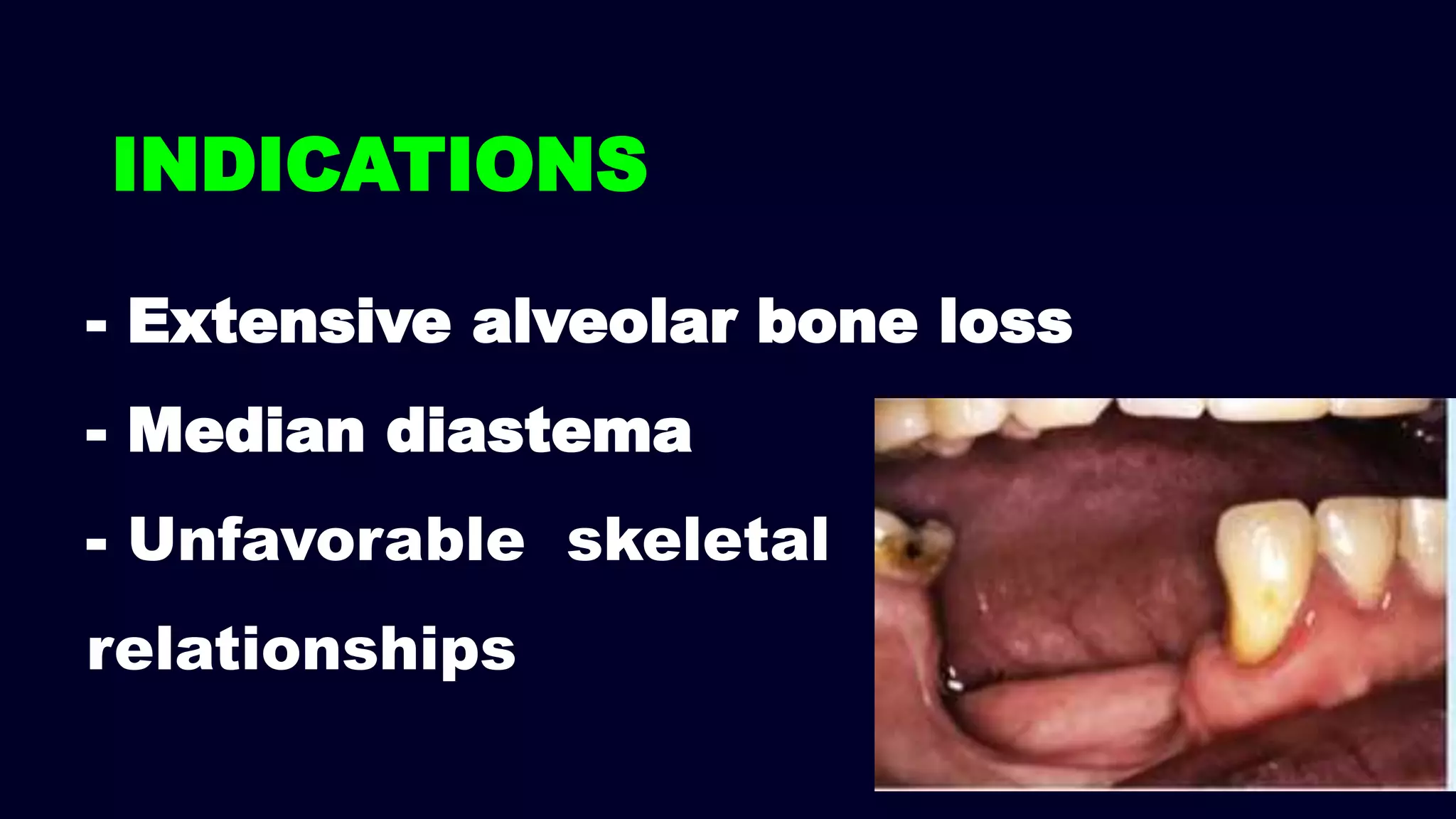 - Extensive alveolar bone loss
- Median diastema
- Unfavorable skeletal
relationships
INDICATIONS
 