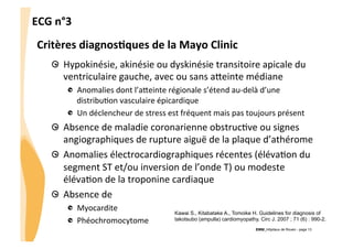 ECG	
  n°3	
  
Critères	
  diagnos3ques	
  de	
  la	
  Mayo	
  Clinic	
  
"   Hypokinésie,	
  akinésie	
  ou	
  dyskinésie	
  transitoire	
  apicale	
  du	
  
ventriculaire	
  gauche,	
  avec	
  ou	
  sans	
  aveinte	
  médiane	
  
"   Anomalies	
  dont	
  l’aveinte	
  régionale	
  s’étend	
  au-­‐delà	
  d’une	
  
distribuGon	
  vasculaire	
  épicardique	
  
"   Un	
  déclencheur	
  de	
  stress	
  est	
  fréquent	
  mais	
  pas	
  toujours	
  présent	
  	
  

"   Absence	
  de	
  maladie	
  coronarienne	
  obstrucGve	
  ou	
  signes	
  
angiographiques	
  de	
  rupture	
  aiguë	
  de	
  la	
  plaque	
  d’athérome	
  	
  
"   Anomalies	
  électrocardiographiques	
  récentes	
  (élévaGon	
  du	
  
segment	
  ST	
  et/ou	
  inversion	
  de	
  l’onde	
  T)	
  ou	
  modeste	
  
élévaGon	
  de	
  la	
  troponine	
  cardiaque	
  
"   Absence	
  de	
  
"   Myocardite	
  
"   Phéochromocytome	
  

Kawai S., Kitabatake A., Tomoike H. Guidelines for diagnosis of
takotsubo (ampulla) cardiomyopathy. Circ J. 2007 ; 71 (6) : 990-2.
CHU_Hôpitaux de Rouen - page 13

 