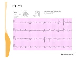 ECG	
  n°1	
  

!
CHU_Hôpitaux de Rouen - page 2

 
