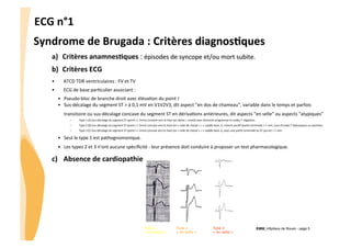 ECG	
  n°1	
  
Syndrome	
  de	
  Brugada	
  :	
  Critères	
  diagnos3ques	
  
a)  Critères	
  anamnes3ques	
  :	
  épisodes	
  de	
  syncope	
  et/ou	
  mort	
  subite.	
  
b)  Critères	
  ECG

	
  	
  

• 

ATCD	
  TDR	
  ventriculaires	
  :	
  FV	
  et	
  TV	
  

• 

ECG	
  de	
  base	
  parGculier	
  associant	
  :	
  
•  Pseudo-­‐bloc	
  de	
  branche	
  droit	
  avec	
  élévaGon	
  du	
  point	
  J	
  
•  Sus-­‐décalage	
  du	
  segment	
  ST	
  >	
  à	
  0,1	
  mV	
  en	
  V1V2V3,	
  dit	
  aspect	
  "en	
  dos	
  de	
  chameau",	
  variable	
  dans	
  le	
  temps	
  et	
  parfois	
  
transitoire	
  ou	
  sus-­‐décalage	
  concave	
  du	
  segment	
  ST	
  en	
  dérivaGons	
  antérieures,	
  dit	
  aspects	
  "en	
  selle"	
  ou	
  aspects	
  "atypiques"	
  	
  
– 

Type	
  1	
  (A)	
  Sus-­‐décalage	
  du	
  segment	
  ST	
  (point	
  J	
  >	
  2mm)	
  convexe	
  vers	
  le	
  haut	
  (en	
  dôme	
  =	
  coved)	
  avec	
  descente	
  progressive	
  et	
  ondes	
  T	
  négaGves	
  

– 

Type	
  2	
  (B)	
  Sus-­‐décalage	
  du	
  segment	
  ST	
  (point	
  J	
  >	
  2mm)	
  concave	
  vers	
  le	
  haut	
  (en	
  «	
  selle	
  de	
  cheval	
  »	
  =	
  «	
  saddle	
  back	
  »),	
  restant	
  posiGf	
  (parGe	
  terminale	
  >	
  1	
  mm,	
  suivi	
  d'ondes	
  T	
  biphasiques	
  ou	
  posiGves.	
  

– 

Type	
  3	
  (C)	
  Sus-­‐décalage	
  du	
  segment	
  ST	
  (point	
  J	
  >	
  2mm)	
  concave	
  vers	
  le	
  haut	
  (en	
  «	
  selle	
  de	
  cheval	
  »	
  =	
  «	
  saddle	
  back	
  »),	
  avec	
  une	
  parGe	
  terminale	
  du	
  ST	
  qui	
  est	
  <	
  1	
  mm.	
  

•  Seul	
  le	
  type	
  1	
  est	
  pathognomonique.	
  	
  
•  Les	
  types	
  2	
  et	
  3	
  n'ont	
  aucune	
  spéciﬁcité	
  :	
  leur	
  présence	
  doit	
  conduire	
  à	
  proposer	
  un	
  test	
  pharmacologique.	
  

c)	
   	
  Absence	
  de	
  cardiopathie	
  

Type 1
« en dôme »

Type 2
« en selle »

Type 3
« en selle »

CHU_Hôpitaux de Rouen - page 5

 