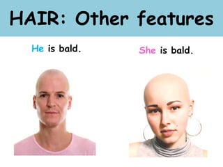 HAIR: Other features
He is bald. She is bald.
 