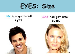 EYES: Size
He has got small
eyes.
She has got small
eyes.
 