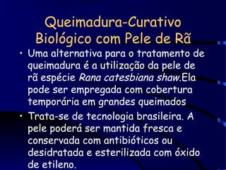 Queimadura-Curativo
Biológico com Pele de Rã
• Uma alternativa para o tratamento de
queimadura é a utilização da pele de
rã espécie Rana catesbiana shaw.Ela
pode ser empregada com cobertura
temporária em grandes queimados
• Trata-se de tecnologia brasileira. A
pele poderá ser mantida fresca e
conservada com antibióticos ou
desidratada e esterilizada com óxido
de etileno.
 