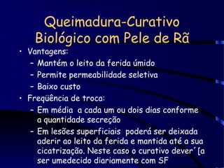 Queimadura-Curativo
Biológico com Pele de Rã
• Vantagens:
– Mantém o leito da ferida úmido
– Permite permeabilidade seletiva
– Baixo custo
• Freqüência de troca:
– Em média a cada um ou dois dias conforme
a quantidade secreção
– Em lesões superficiais poderá ser deixada
aderir ao leito da ferida e mantida até a sua
cicatrização. Neste caso o curativo dever´[a
ser umedecido diariamente com SF
 