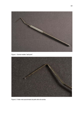 60
Figura 1: Sonda modelo “ball point”.
Figura 2: Visão mais aproximada da parte ativa da sonda.
 