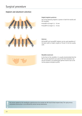 The torsion applied to the mandibular superstructure lies outside the SKY fast  fixed implant beds. The rigid primary
interlocked construction is not affected by torsion during mastication.
28
Surgical procedure
Implant and abutment selection
Angled implants posterior:
Use of the following implants is proven in both the maxilla and
the mandible:
• blueSKY 4.0 length 12 - 16 mm
• blueSKY 4.5 length 12 - 14 mm
Anterior:
All blueSKY and narrowSKY implants can be used regardless of
the bone width or height. Lengths of 10 and 12 mm are usually
used.
Mandible (anterior):
In the front of the mandible, it is usually recommended that the
SKY uni.cone abutments are used as the final restoration can
also be finished in an aesthetically optimal manner due to the
narrow gingiva emergence profile.
 