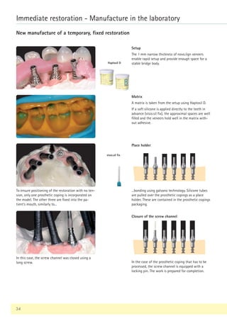 34
Immediate restoration - Manufacture in the laboratory
In this case, the screw channel was closed using a
long screw.
Setup
The 1 mm narrow thickness of novo.lign veneers
enable rapid setup and provide enough space for a
stable bridge body.
Matrix
A matrix is taken from the setup using Haptosil D.
If a soft silicone is applied directly to the teeth in
advance (visio.sil fix), the approximal spaces are well
filled and the veneers hold well in the matrix with-
out adhesive.
To ensure positioning of the restoration with no ten-
sion, only one prosthetic coping is incorporated on
the model. The other three are fixed into the pa-
tient‘s mouth, similarly to...
In the case of the prosthetic coping that has to be
processed, the screw channel is equipped with a
locking pin. The work is prepared for completion.
Closure of the screw channel
Place holder
...bonding using galvano technology. Silicone tubes
are pulled over the prosthetic copings as a place
holder. These are contained in the prosthetic copings
packaging.
visio.sil fix
Haptosil D
New manufacture of a temporary, fixed restoration
 