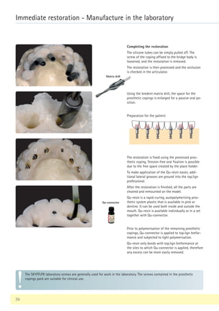36
Immediate restoration - Manufacture in the laboratory
The SKYFFLPK laboratory screws are generally used for work in the laboratory. The screws contained in the prosthetic
copings pack are suitable for clinical use.
Completing the restoration
The silicone tubes can be simply pulled off. The
screw of the coping affixed to the bridge body is
loosened, and the restoration is removed.
The restoration is then processed and the occlusion
is checked in the articulator.
Matrix drill
Qu-connector
Using the bredent matrix drill, the space for the
prosthetic copings is enlarged for a passive oral po-
sition.
The restoration is fixed using the processed pros-
thetic coping. Tension-free oral fixation is possible
due to the free space created by the place holder.
To make application of the Qu-resin easier, addi-
tional lateral grooves are ground into the top.lign
professional.
After the restoration is finished, all the parts are
cleaned and remounted on the model.
Qu-resin is a rapid-curing, autopolymerising pros-
thetic system plastic that is available in pink or
dentine. It can be used both inside and outside the
mouth. Qu-resin is available individually or in a set
together with Qu-connector.
Preparation for the patient
Prior to polymerisation of the remaining prosthetic
copings, Qu-connector is applied to top.lign brefor-
mance and subjected to light polymerisation.
Qu-resin only bonds with top.lign breformance at
the sites to which Qu-connector is applied, therefore
any excess can be more easily removed.
 
