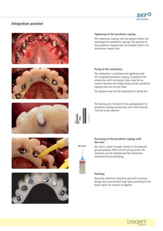 Tightening of the prosthetic copings
The impression copings and the gingiva former are
exchanged for prosthetic copings. The position of
the prosthetic copings that are already fixed in the
restoration remain free.
Fixing of the restoration
The restoration is attached and tightened with
the integrated prosthetic coping. To position the
restoration with no tension, there must be no
contact between the bridge body and the prosthetic
copings that are not yet fixed.
The gingiva must not be compressed in doing this.
Processing of the prosthetic copings with
Qu-resin
Qu-resin is easier to apply thanks to the laterally
ground grooves. After a brief curing period, the
occlusion can be checked and the restoration
removed for final polishing.
Polishing
Particular attention should be paid with a convex
design and conscientious high-gloss polishing of the
basal region for reasons of hygiene.
Qu-resin
Integration practice
The locking pins included in the packaging set for
prosthetic copings prevent Qu-resin from flowing
into the screw channel.
 