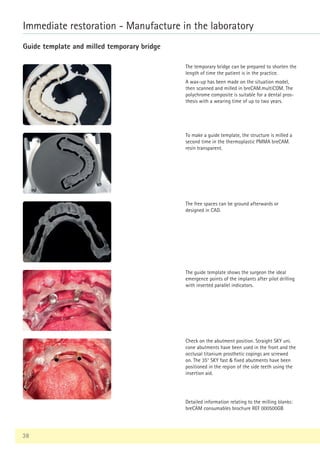 38
Immediate restoration - Manufacture in the laboratory
Guide template and milled temporary bridge
The temporary bridge can be prepared to shorten the
length of time the patient is in the practice.
A wax-up has been made on the situation model,
then scanned and milled in breCAM.multiCOM. The
polychrome composite is suitable for a dental pros-
thesis with a wearing time of up to two years.
To make a guide template, the structure is milled a
second time in the thermoplastic PMMA breCAM.
resin transparent.
The free spaces can be ground afterwards or
designed in CAD.
The guide template shows the surgeon the ideal
emergence points of the implants after pilot drilling
with inserted parallel indicators.
Check on the abutment position. Straight SKY uni.
cone abutments have been used in the front and the
occlusal titanium prosthetic copings are screwed
on. The 35° SKY fast  fixed abutments have been
positioned in the region of the side teeth using the
insertion aid.
Detailed information relating to the milling blanks:
breCAM consumables brochure REF 000500GB
 