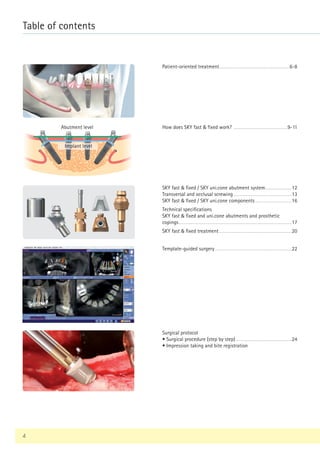 Patient-oriented treatment.................................................................6-8
Abutment level
Implant level
How does SKY fast & fixed work? ..................................................9-11
SKY fast & fixed / SKY uni.cone abutment system.........................12
Transversal and occlusal screwing......................................................13
SKY fast & fixed / SKY uni.cone components..................................16
Technical specifications
SKY fast & fixed and uni.cone abutments and prosthetic
copings........................................................................................................17
SKY fast & fixed treatment...................................................................20
Template-guided surgery.......................................................................22
Surgical protocol
• Surgical procedure (step by step)....................................................24
• Impression taking and bite registration
Table of contents
4
 