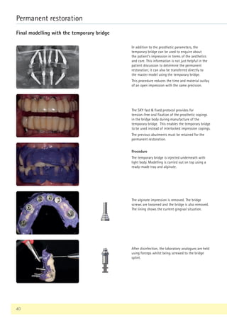 40
Permanent restoration
Final modelling with the temporary bridge
The SKY fast  fixed protocol provides for
tension-free oral fixation of the prosthetic copings
in the bridge body during manufacture of the
temporary bridge. This enables the temporary bridge
to be used instead of interlocked impression copings.
The previous abutments must be retained for the
permanent restoration.
In addition to the prosthetic parameters, the
temporary bridge can be used to enquire about
the patient's impression in terms of the aesthetics
and care. This information is not just helpful in the
patient discussion to determine the permanent
restoration; it can also be transferred directly to
the master model using the temporary bridge.
This procedure reduces the time and material outlay
of an open impression with the same precision.
Procedure
The temporary bridge is injected underneath with
light body. Modelling is carried out on top using a
ready-made tray and alginate.
The alginate impression is removed. The bridge
screws are loosened and the bridge is also removed.
The lining shows the current gingival situation.
After disinfection, the laboratory analogues are held
using forceps whilst being screwed to the bridge
splint.
 
