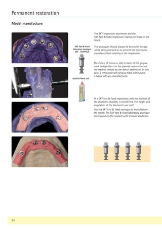 44
Permanent restoration
The SKY impression abutments and the
SKY fast  fixed impression copings are fixed in the
block.
The analogues should always be held with forceps
while being screwed on to prevent the impression
abutments from rotating in the impression.
The choice of firmness, soft or hard, of the gingiva
mask is dependent on the planned restoration and
the method chosen by the dental technician. In this
case, a removable soft gingiva mask with Multis-
il-Mask soft was manufactured.
SKY fast  fixed
laboratory analogue
REF SKYFFTLA
In a SKY fast  fixed impression, only the position of
the abutment shoulder is transferred. The height and
angulation of the abutments are not!
Use the SKY fast  fixed analogue to manufacture
the model. The SKY fast  fixed laboratory analogue
corresponds to the implant with screwed abutment.
Model manufacture
Multisil-Mask soft
 