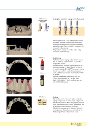 MKZ Primer
visio.link
DTK adhesive
SKY fast  fixed
prosthetic coping
CAD/CAM
The straight titanium CAD/CAM prosthetic copings
are used in this case. In comparison to the titani-
um prosthetic copings with retentions, they have a
low wall strength. There is therefore more space for
framework and veneering.
The prosthetic copings are bonded to the bridge
framework in the next step.
Bonding the prosthetic copings in the framework
Conditioning
The framework, the copings and abutment regions
that are not to be conditioned can be protected
using wax or silicone.
After blasting the prosthetic copings with 110 µm
aluminium oxide at 3 - 4 bar, clean in oil-free air
jet or using a brush. Drip MKZ Primer onto a mixing
plate or tray, brush the prosthetic copings using a
single-use brush and leave to dry for approximately
30 seconds.
Blast the framework at the bonding sites with
110 µm aluminium oxide at 2 bar and clean.
Apply visio.link using a single-use brush and cure
with light for 90 seconds.
Bonding
Oral bonding of the framework to the prosthetic
copings compensates for inaccuracies and prevents
the creation of tension. After verifying the precision
of the master model using a splint, bonding can also
be carried out under laboratory conditions.
DTK adhesive is a dual-curing (light and autopoly-
merising), paste-like dual component material for
the bonding of metal and zirconium oxide.
 
