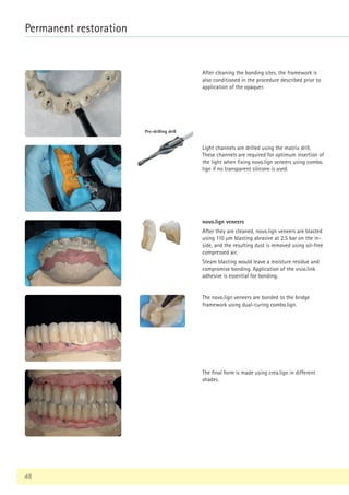 48
Permanent restoration
Pre-drilling drill
After cleaning the bonding sites, the framework is
also conditioned in the procedure described prior to
application of the opaquer.
Light channels are drilled using the matrix drill.
These channels are required for optimum insertion of
the light when fixing novo.lign veneers using combo.
lign if no transparent silicone is used.
novo.lign veneers
After they are cleaned, novo.lign veneers are blasted
using 110 µm blasting abrasive at 2.5 bar on the in-
side, and the resulting dust is removed using oil-free
compressed air.
Steam blasting would leave a moisture residue and
compromise bonding. Application of the visio.link
adhesive is essential for bonding.
The novo.lign veneers are bonded to the bridge
framework using dual-curing combo.lign.
The final form is made using crea.lign in different
shades.
 