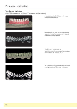 50
Permanent restoration
Two-in-one technique
CAD/CAM-supported milling of framework and veneering
A data set is created by digitalising the master
model and aesthetic try-in.
On the basis of this, the CAD software creates a
suggestion for the framework, which is adapted
to the individual requirements.
One data set – two structures
Two milling orders for veneers and framework are
generated from the aesthetic try-in.
The framework material is agreed with the person
treating the patient. A CoCr alloy in this case.
 
