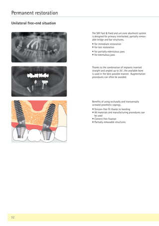 52
Permanent restoration
Unilateral free-end situation
The SKY fast  fixed and uni.cone abutment system
is designed for primary interlocked, partially remov-
able bridge and bar structures.
• for immediate restoration
• for late restoration
• for partially-edentulous jaws
• for edentulous jaws
Thanks to the combination of implants inserted
straight and angled up to 35°, the available bone
is used in the best possible manner. Augmentation
procedures can often be avoided.
Benefits of using occlusally and transversally
screwed prosthetic copings.
• Tension-free fit thanks to bonding
• All materials and manufacturing procedures can
be used
• Cement-free fixation
• Partially removable structures
 