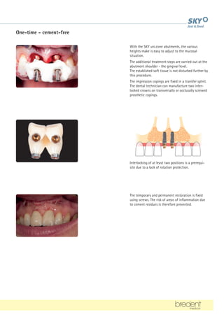 One-time - cement-free
With the SKY uni.cone abutments, the various
heights make is easy to adjust to the mucosal
situation.
The additional treatment steps are carried out at the
abutment shoulder - the gingival level.
The established soft tissue is not disturbed further by
this procedure.
The impression copings are fixed in a transfer splint.
The dental technician can manufacture two inter-
locked crowns on transversally or occlusally screwed
prosthetic copings.
Interlocking of at least two positions is a prerequi-
site due to a lack of rotation protection.
The temporary and permanent restoration is fixed
using screws. The risk of areas of inflammation due
to cement residues is therefore prevented.
 