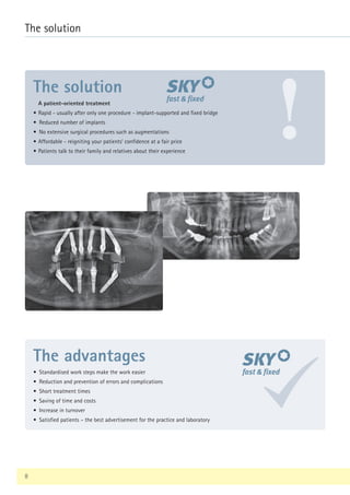 • Standardised work steps make the work easier
• Reduction and prevention of errors and complications
• Short treatment times
• Saving of time and costs
• Increase in turnover
• Satisfied patients – the best advertisement for the practice and laboratory
The advantages
!
A patient-oriented treatment
• Rapid - usually after only one procedure - implant-supported and fixed bridge
• Reduced number of implants
• No extensive surgical procedures such as augmentations
• Affordable - reigniting your patients’ confidence at a fair price
• Patients talk to their family and relatives about their experience
The solution
8
The solution
 