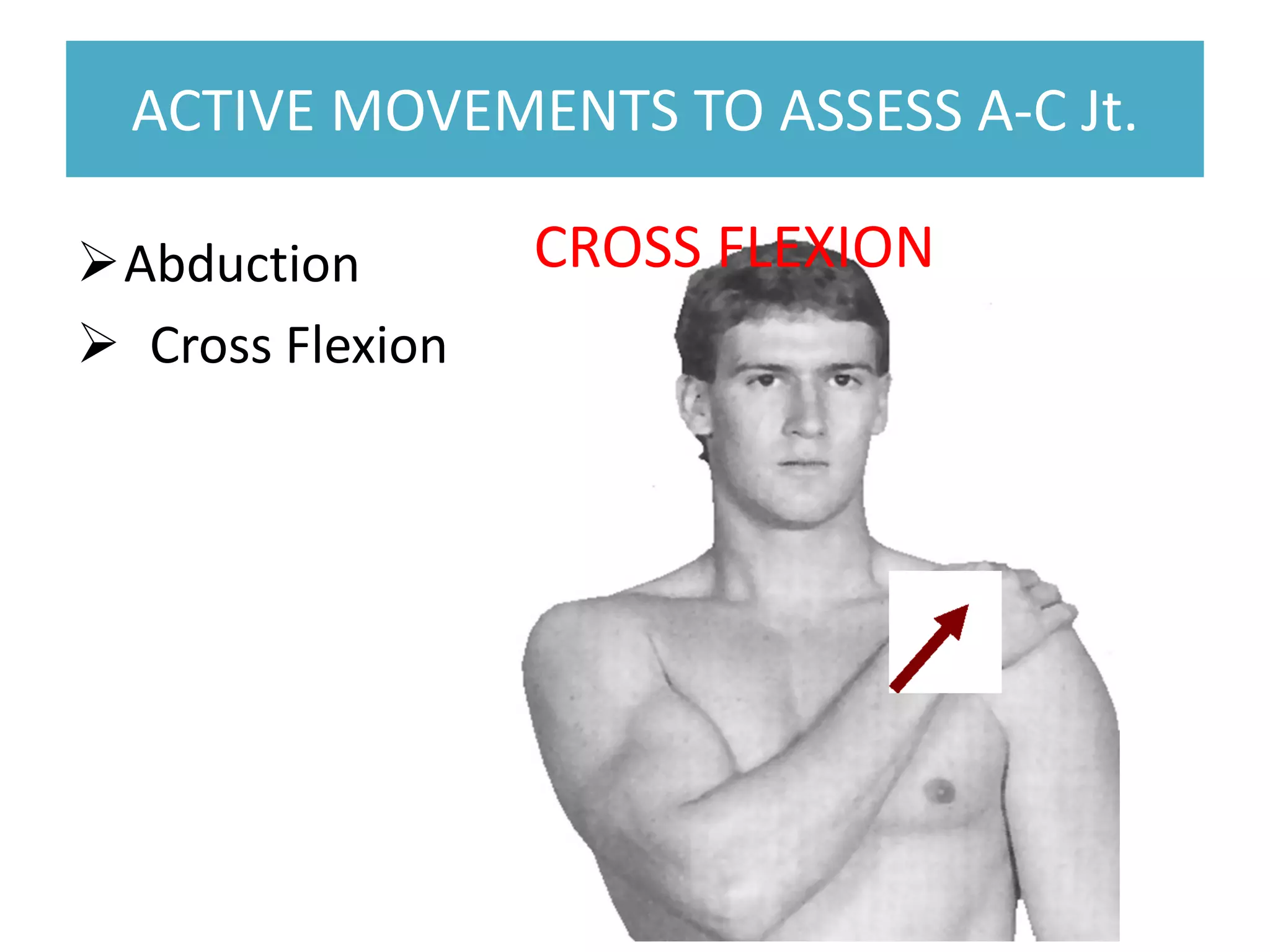 ACTIVE MOVEMENTS TO ASSESS A-C Jt.
ACTIVE MOVEMENTS TO ASSESS A-C Jt.
Abduction
 Cross Flexion
CROSS FLEXION
 
